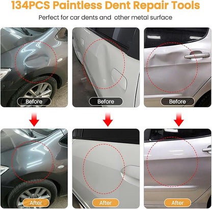 134PCS Dent Puller, Paintless Dent Removal Kit – All-in-One Car Dent Puller Kit - Image 2